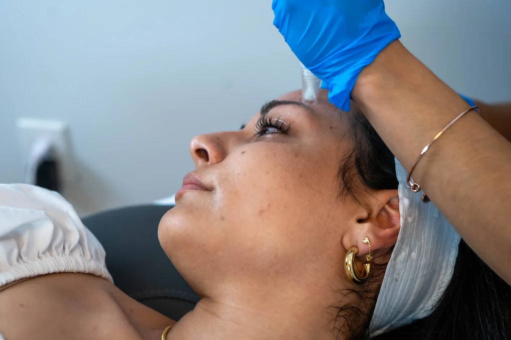 Acne at AgeRejuvenation